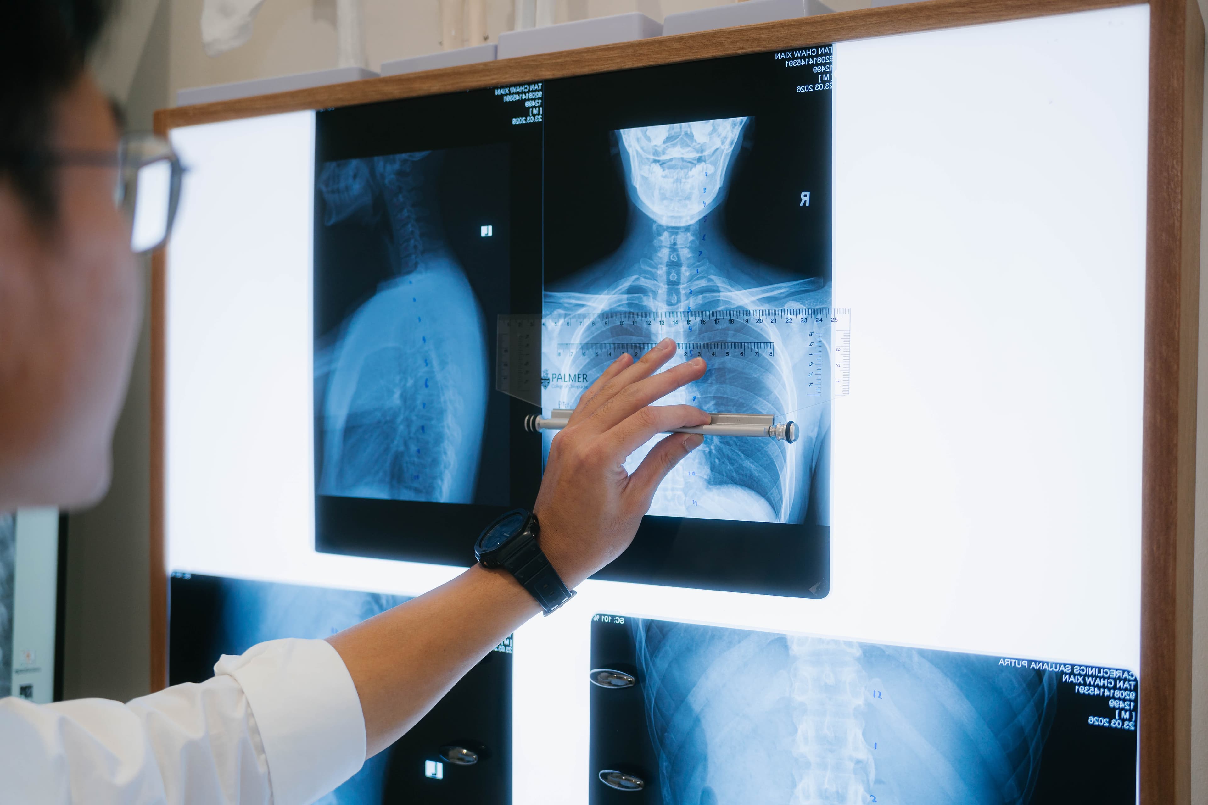 Chiropractic Care & X-rays