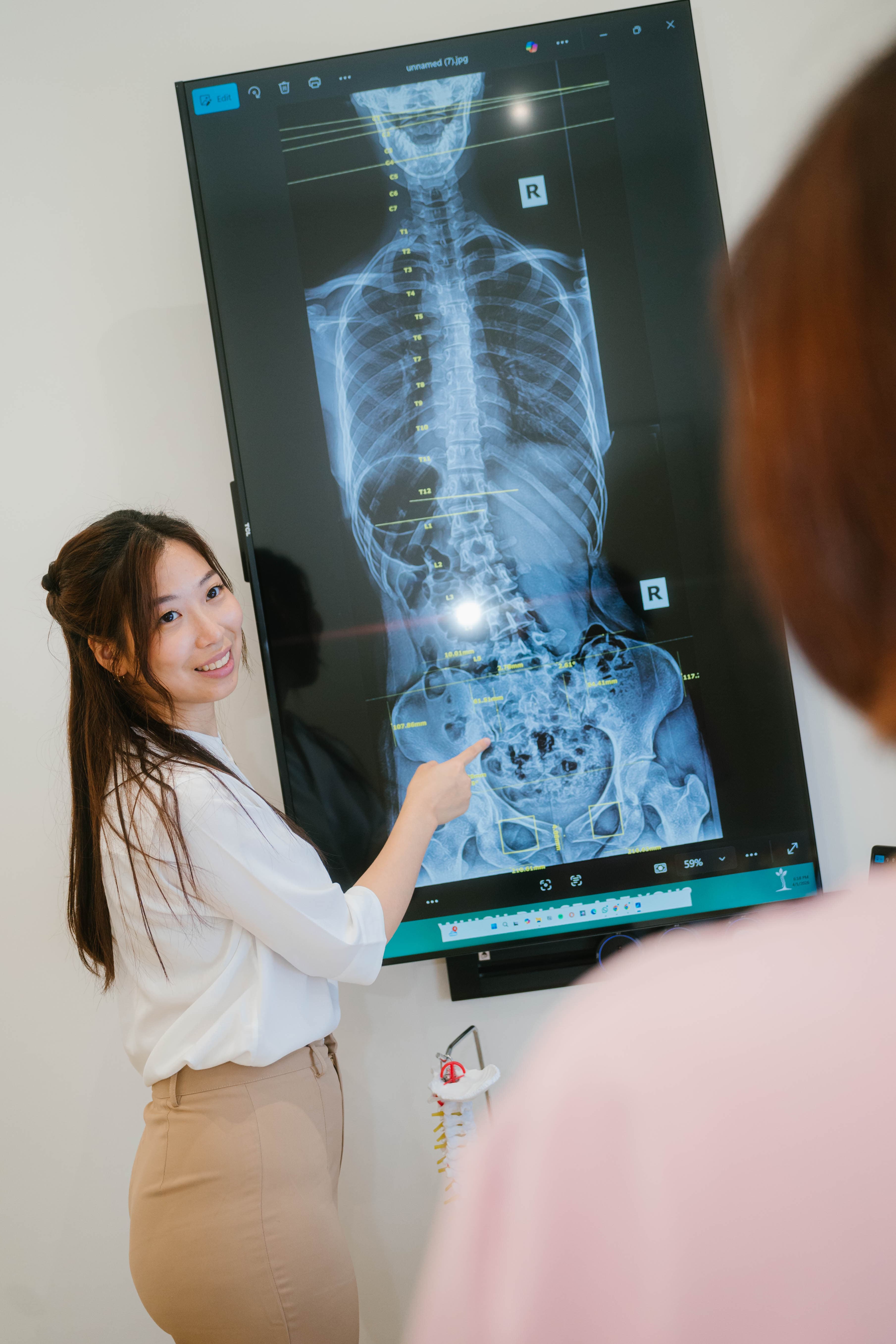Posture & Scoliosis